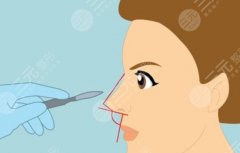 青医附院隆鼻多少钱？假体、肋软骨、鼻综合价格档次逐项看