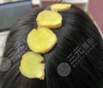 如何增发生发？8月实测有效的增发生发技巧分享，速看！