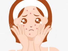 如何去除额头痘痘？这里教你高效去除额头痘痘