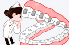 川北医学院口腔正畸科有哪些好的医生｜金属牙套、隐形矫正该找谁面诊