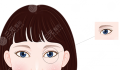 常州一院和二院哪个做双眼皮好｜26年8月选院指南，适合自己才是重点