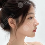 小眼睛变大眼睛化妆怎么样？这几个技巧学会之后眼睛直接大一号