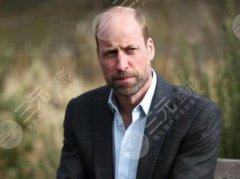 威廉王子秃顶了吗？扒一扒产生原因、解决方式详情