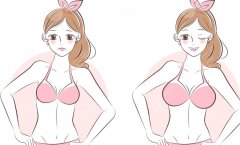 浙医二院隆胸多少钱？假体、脂肪填充费用影响因素解析