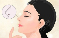 成都中医药大学附属医院做鼻子好吗？自然款鼻型设计重点一次看懂