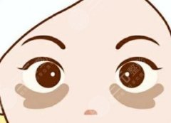 造成黑眼圈的原因有哪些？8月揭秘产生原因、调节方式来了
