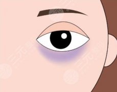 如何消除黑眼圈？分享小妙招+项目科普来啦
