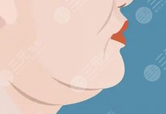 双下巴怎么办？解决方式、产生原因这里扒透啦