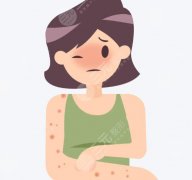 为什么皮肤有时候越抓越痒？正确止痒方式+产生原因这看