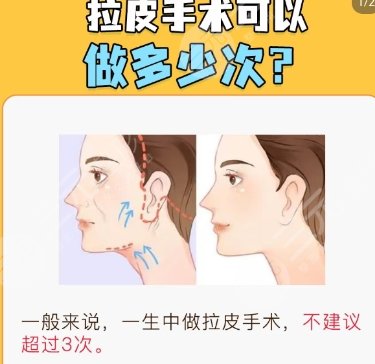 拉皮