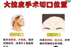 诸城人民医院除皱多少钱？2026收费细节展示！一文看懂真实收费区间