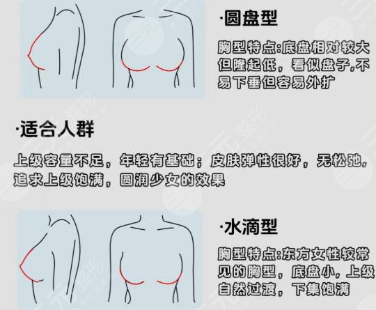 隆胸