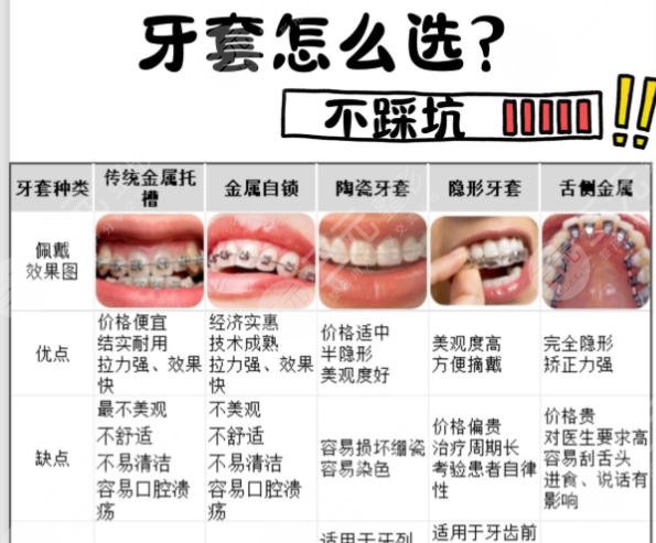 牙齿矫正