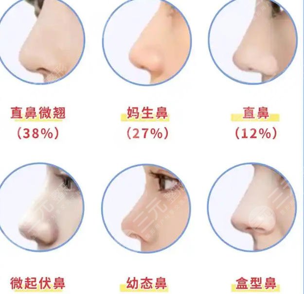 隆鼻