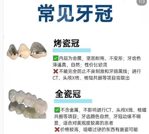 烤瓷牙