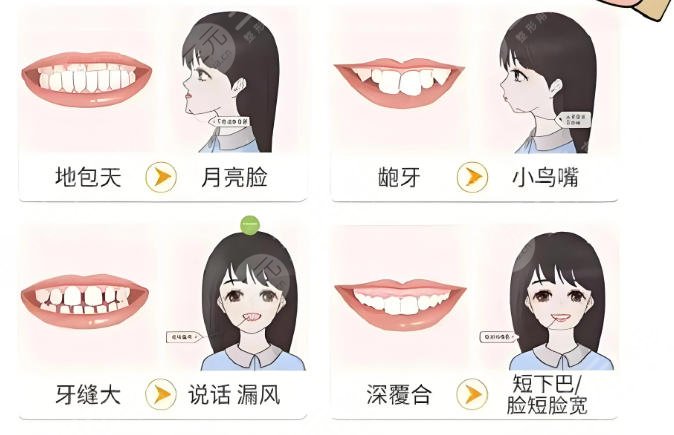 牙齿矫正