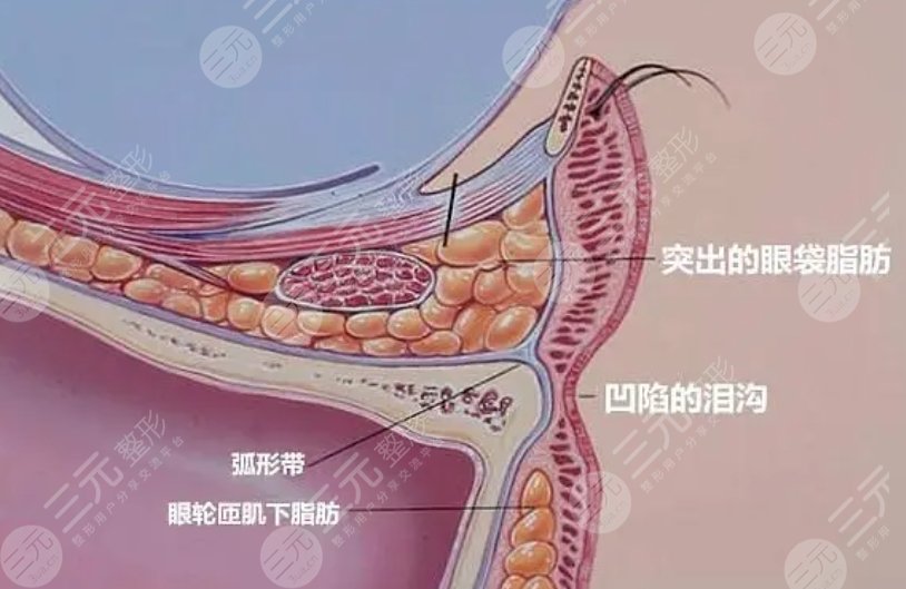 眼袋