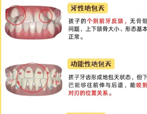 牙齿矫正