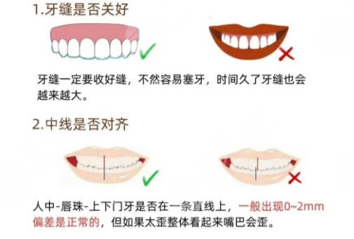 牙齿矫正