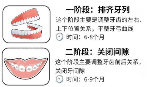 牙齿矫正