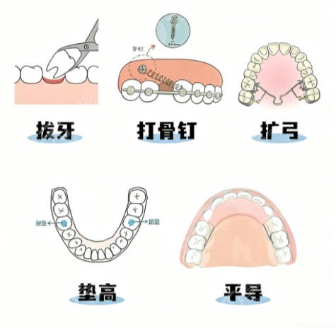 正 畸