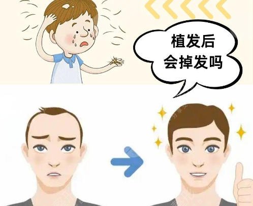 植发