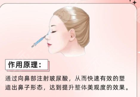 隆鼻