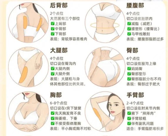 吸脂