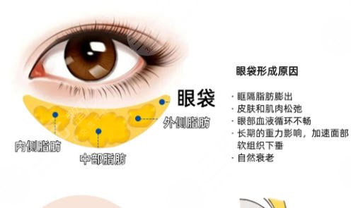 眼袋