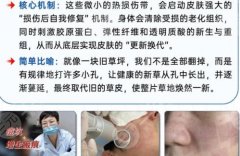 西安点阵激光多少钱一次？项目介绍与医生推荐来袭！