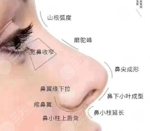 隆鼻