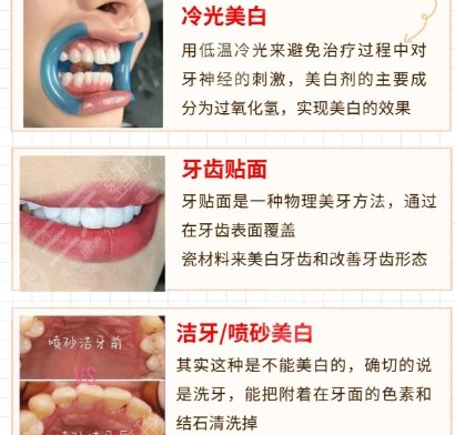 牙齿美白
