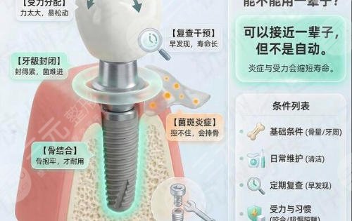 牙齿种植