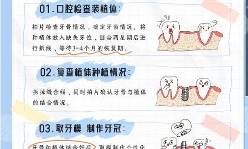牙齿种植