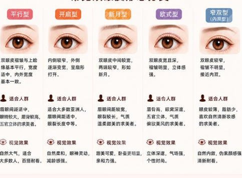 双眼皮
