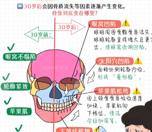 磨骨