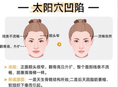 磨骨