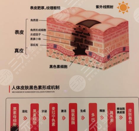 祛斑