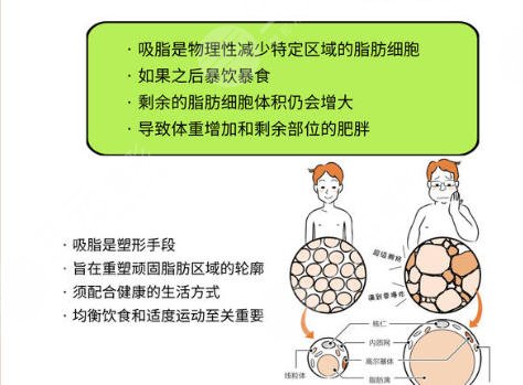 吸脂