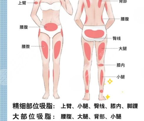 吸脂