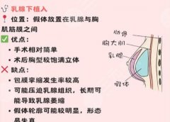 南充中心医院脂肪填充多少钱？整形医生价位表口碑一览