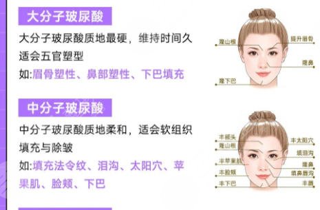 玻尿酸