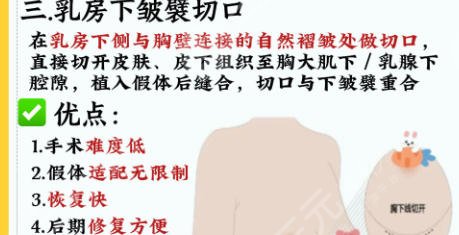 隆胸