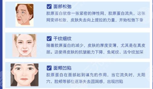 抗衰