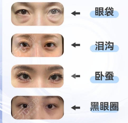 眼袋