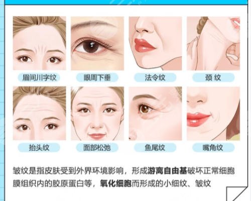除皱