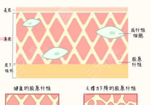 除皱