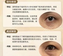 自贡四医院祛眼袋怎么样？去眼袋技术剖析！含2026价格表