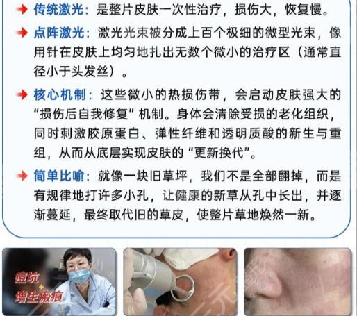 点阵激光