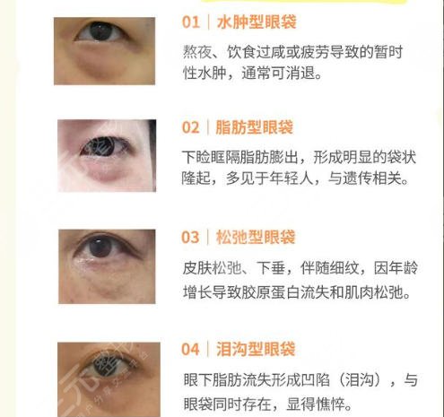 眼袋